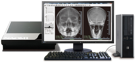 レントゲン読み取りパソコン装置(デジトゲンNAOMI)